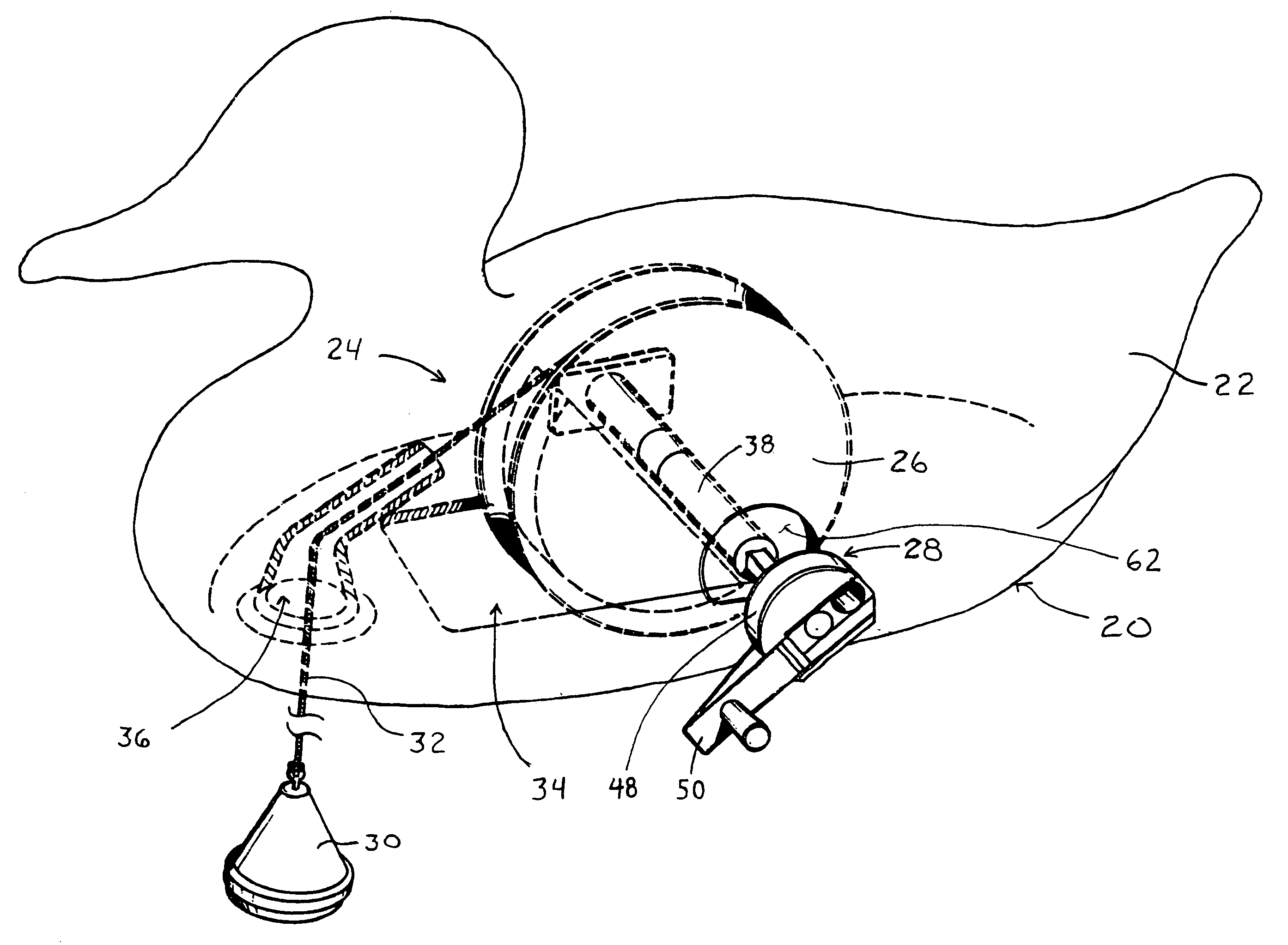 Self-righting waterfowl decoy with integrated anchor and locking mechanism