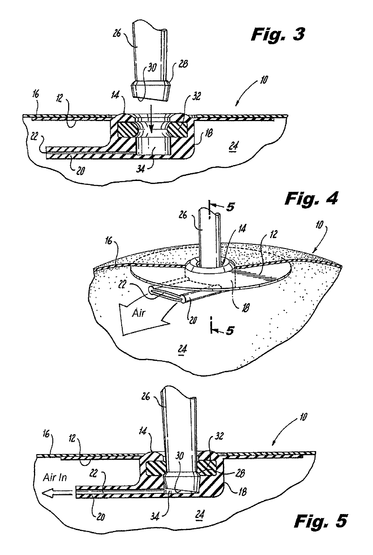 Valve assembly for inflatable bladder and method of manufacturing the same