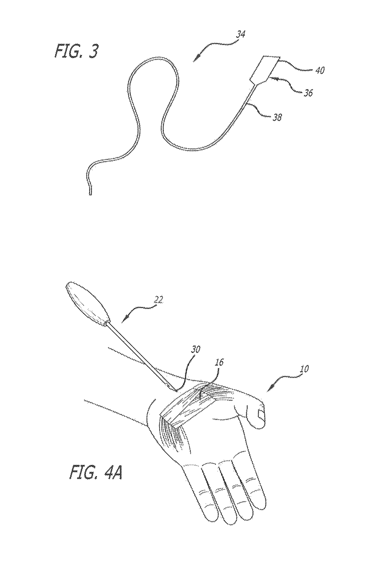 Methods for thread transection of a soft tissue