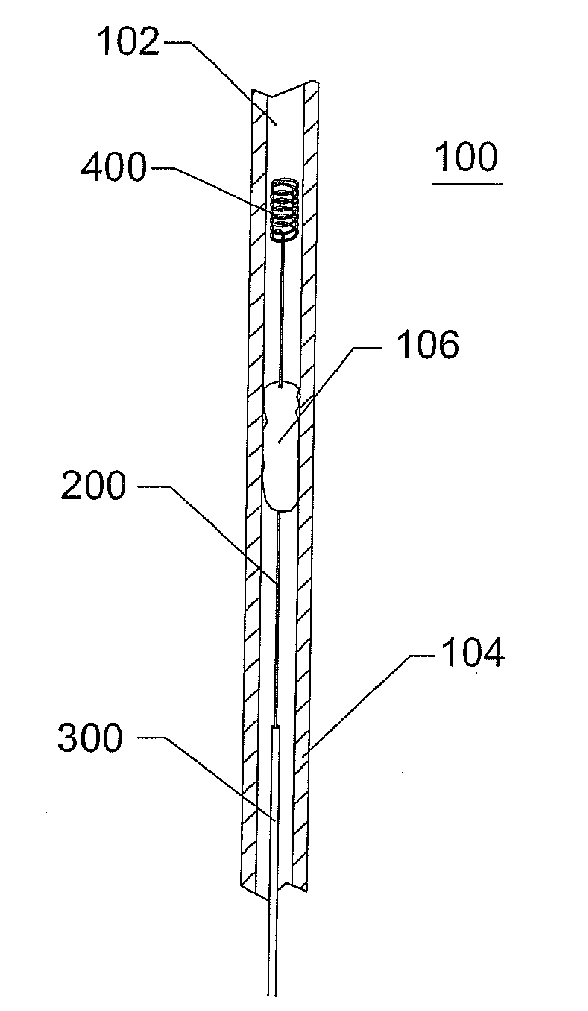 Thrombectomy System and Method
