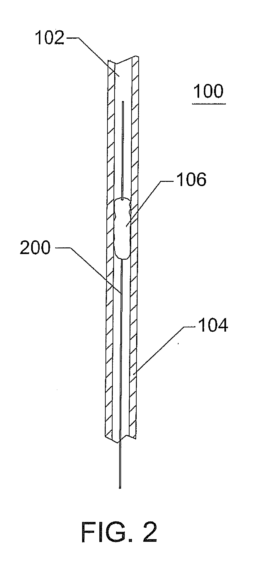 Thrombectomy System and Method