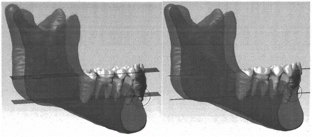Digital tooth arrangement method based on tooth root information