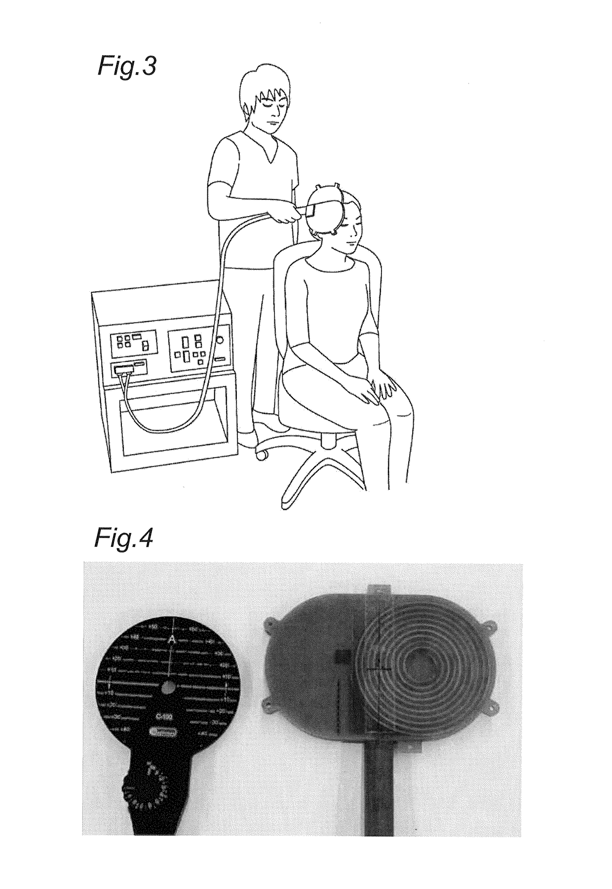 Coil device and transcranial magnetic stimulation system