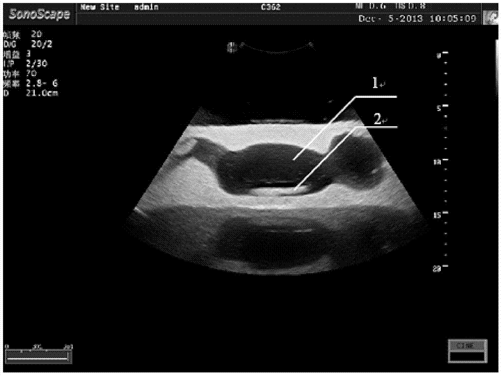 High-precision multi-tissue simulation fetal model