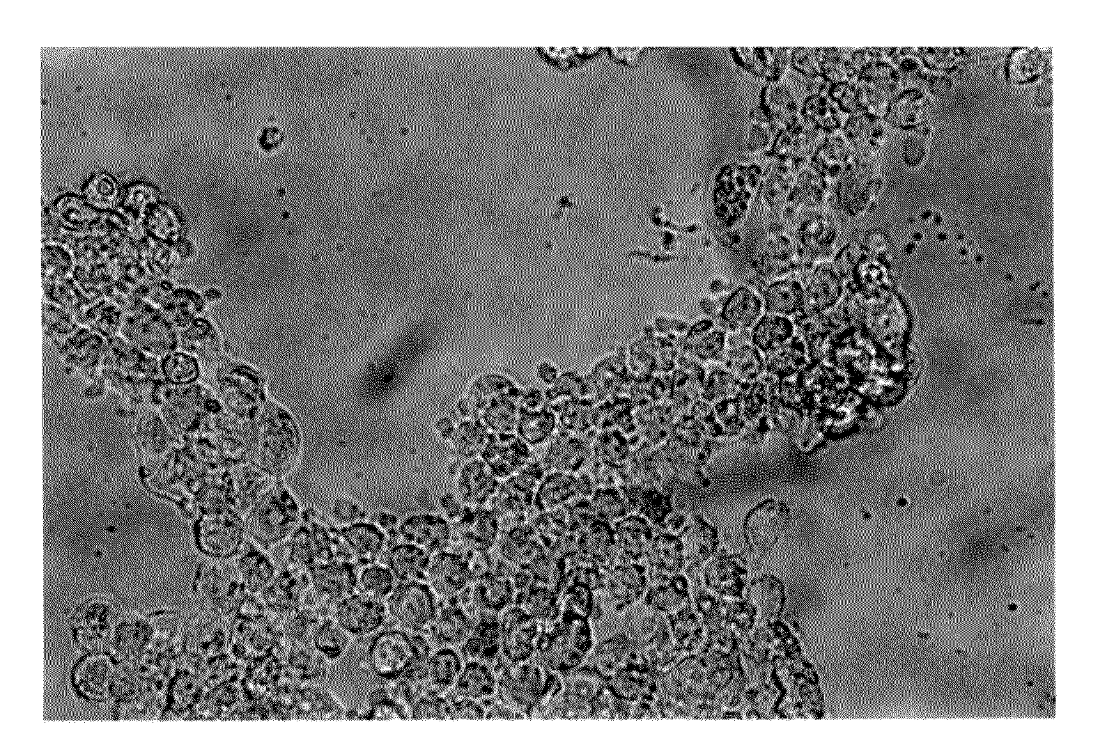 Alpha 1-acid glycoprotein, alpha 2-hs glycoprotein, alpha 1-antitrypsin, and fragments thereof induce apoptosis in cancer cell lines