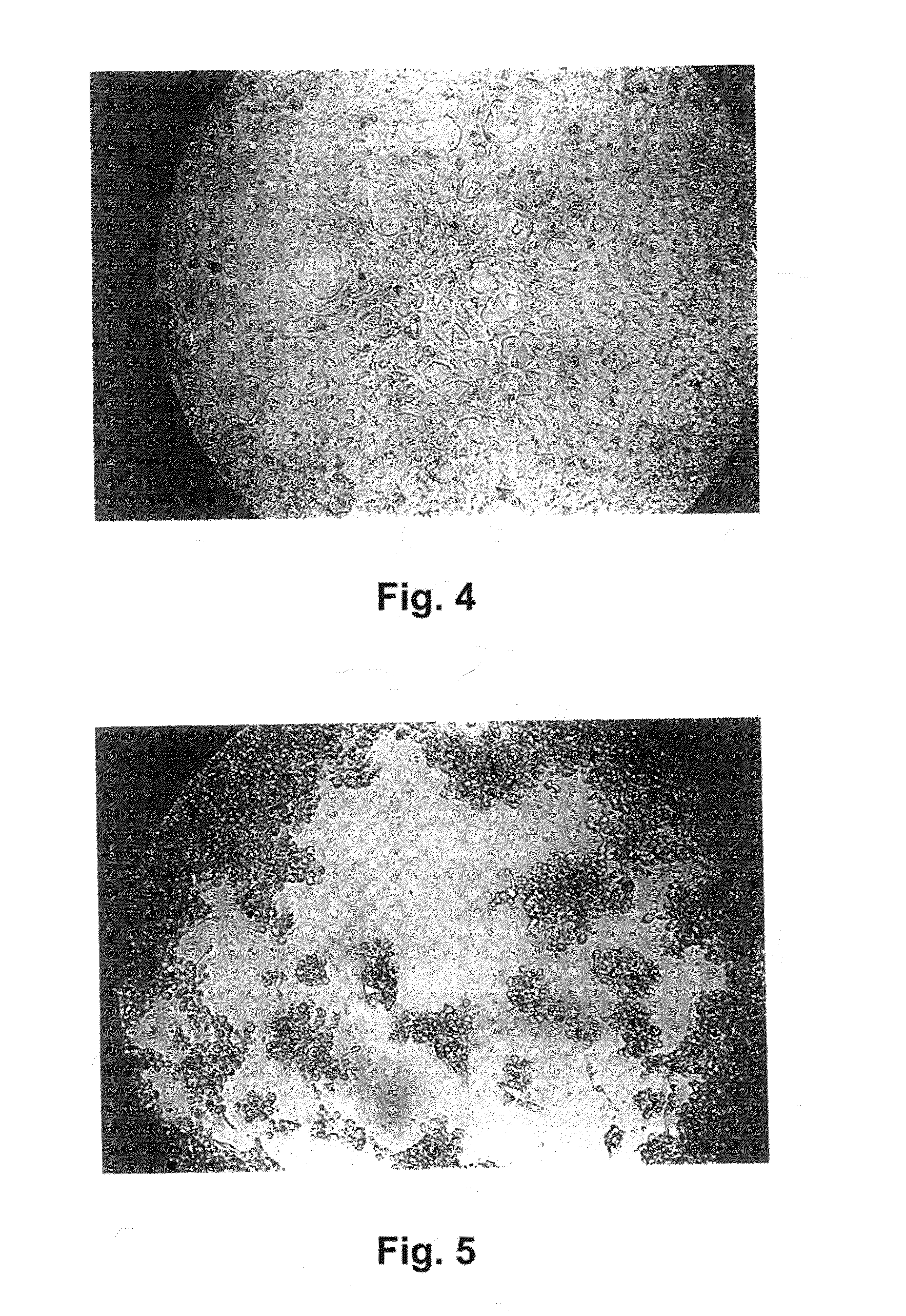 Alpha 1-acid glycoprotein, alpha 2-hs glycoprotein, alpha 1-antitrypsin, and fragments thereof induce apoptosis in cancer cell lines