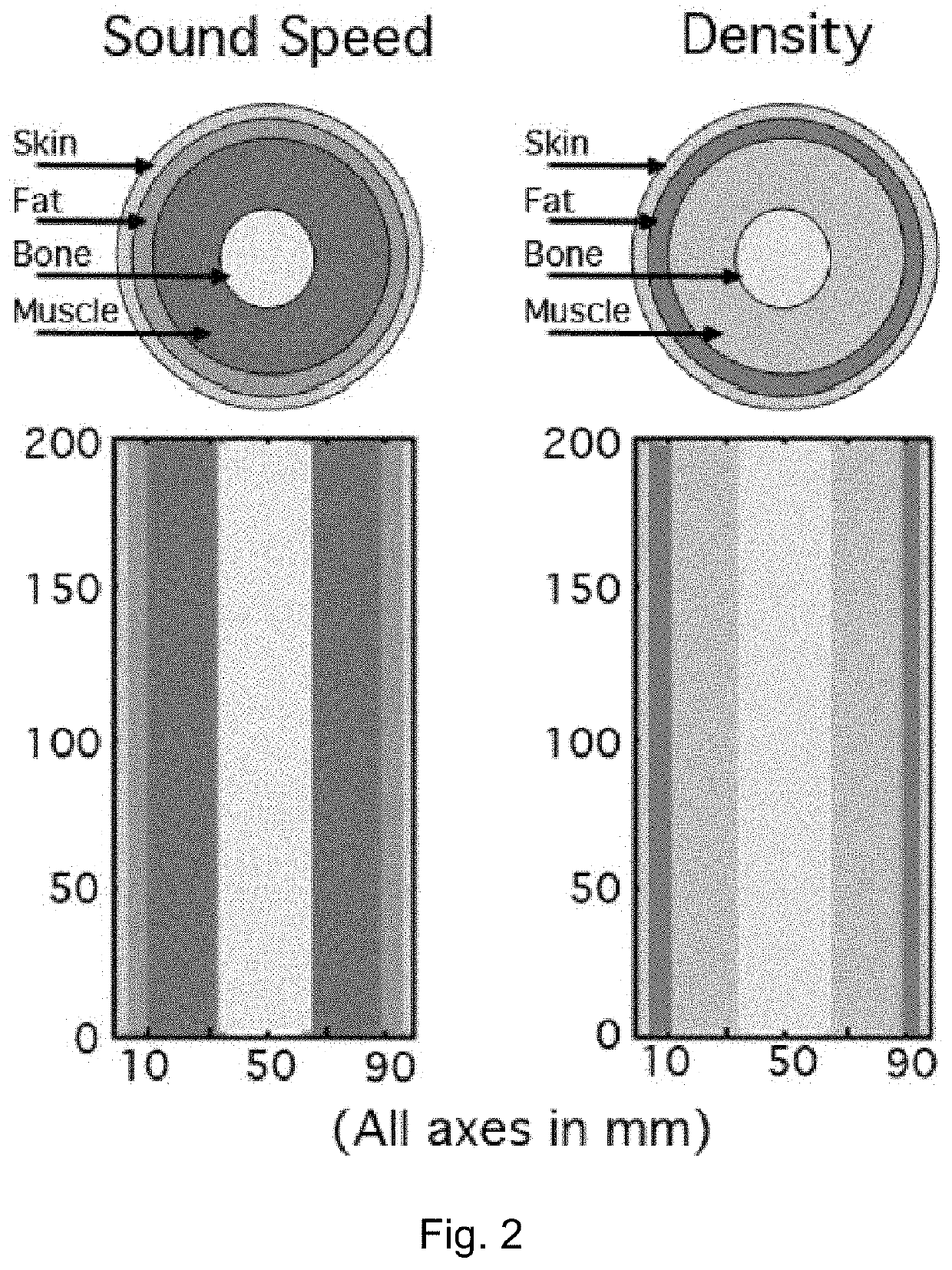 Transmission and medium access control techniques for ultrasonic communications in the body