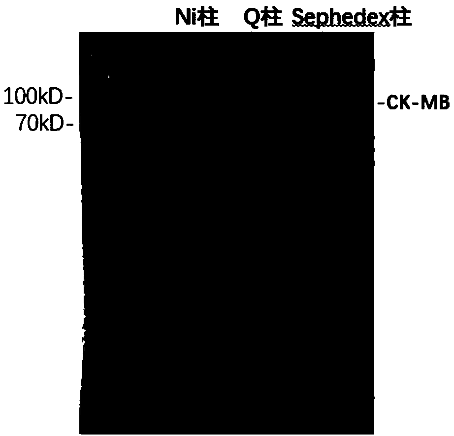 CK-MB fusion protein, preparation method thereof, and detection kit