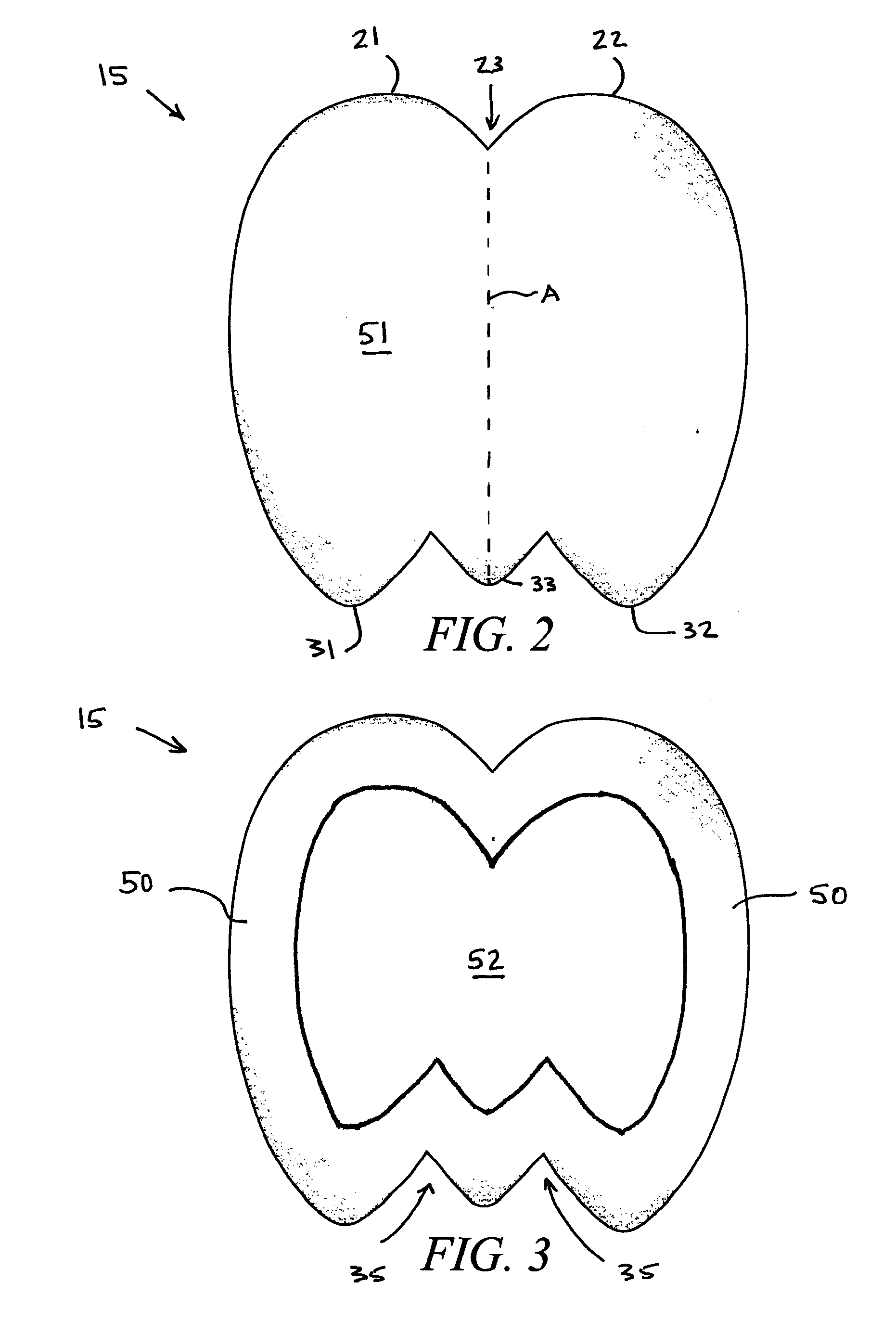 Sacral wound dressing and method of use