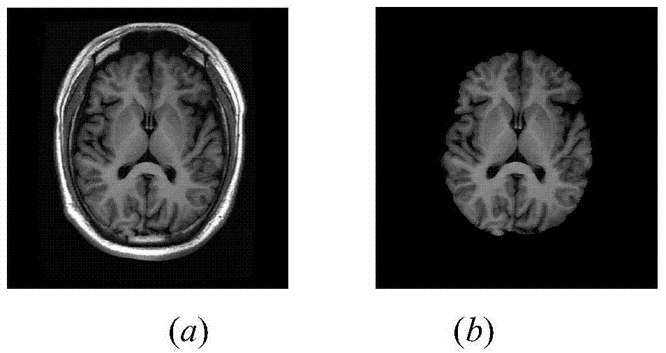 A segmentation method of thalamus and its substructures based on improved fuzzy connectivity algorithm