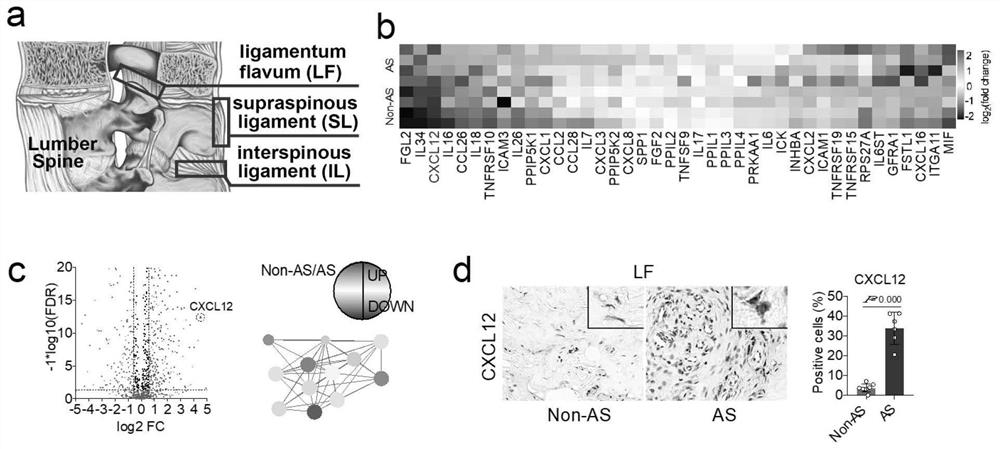 Application of CXCL12/CXCR4 signaling pathway as target spot in preparation of medicine for treating or preventing heterotopic ossification