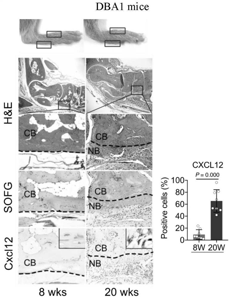 Application of CXCL12/CXCR4 signaling pathway as target spot in preparation of medicine for treating or preventing heterotopic ossification