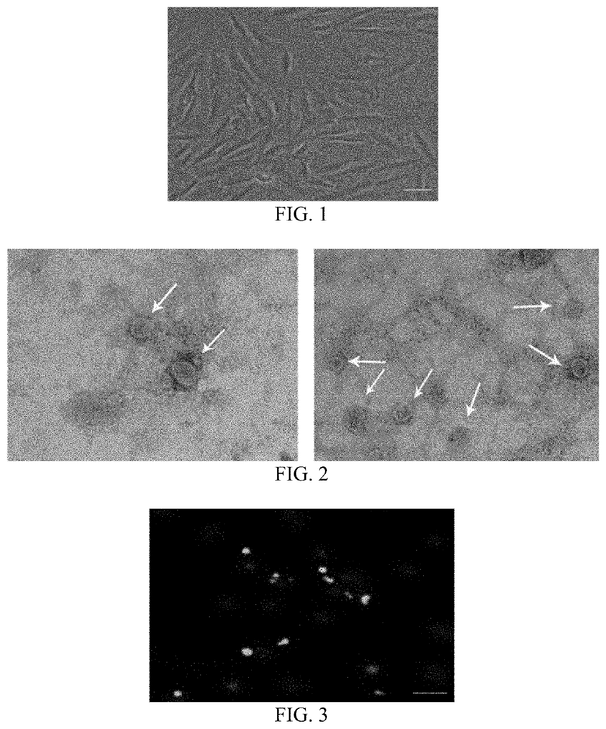 USE OF miRNA IN PREPARATION OF A DRUG FOR PREVENTING AND TREATING OSTEOARTHRITIS, AN EXOSOME HIGHLY EXPRESSING miRNA AND USE THEREOF