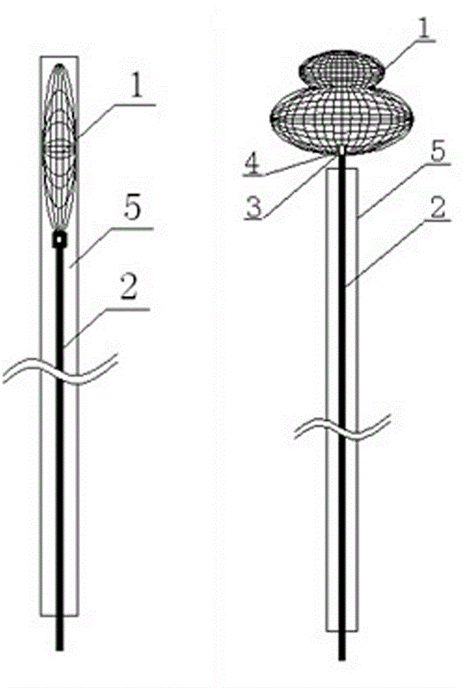 Braided part system for embolizing aneurysm