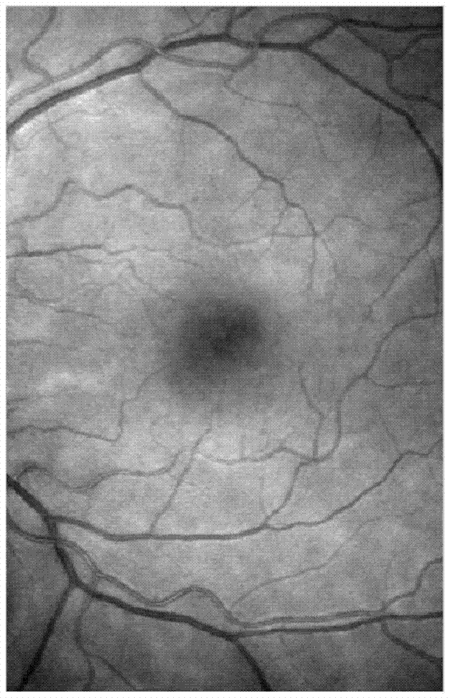 Active contour blood vessel extraction method and system based on multi-feature Gaussian fitting