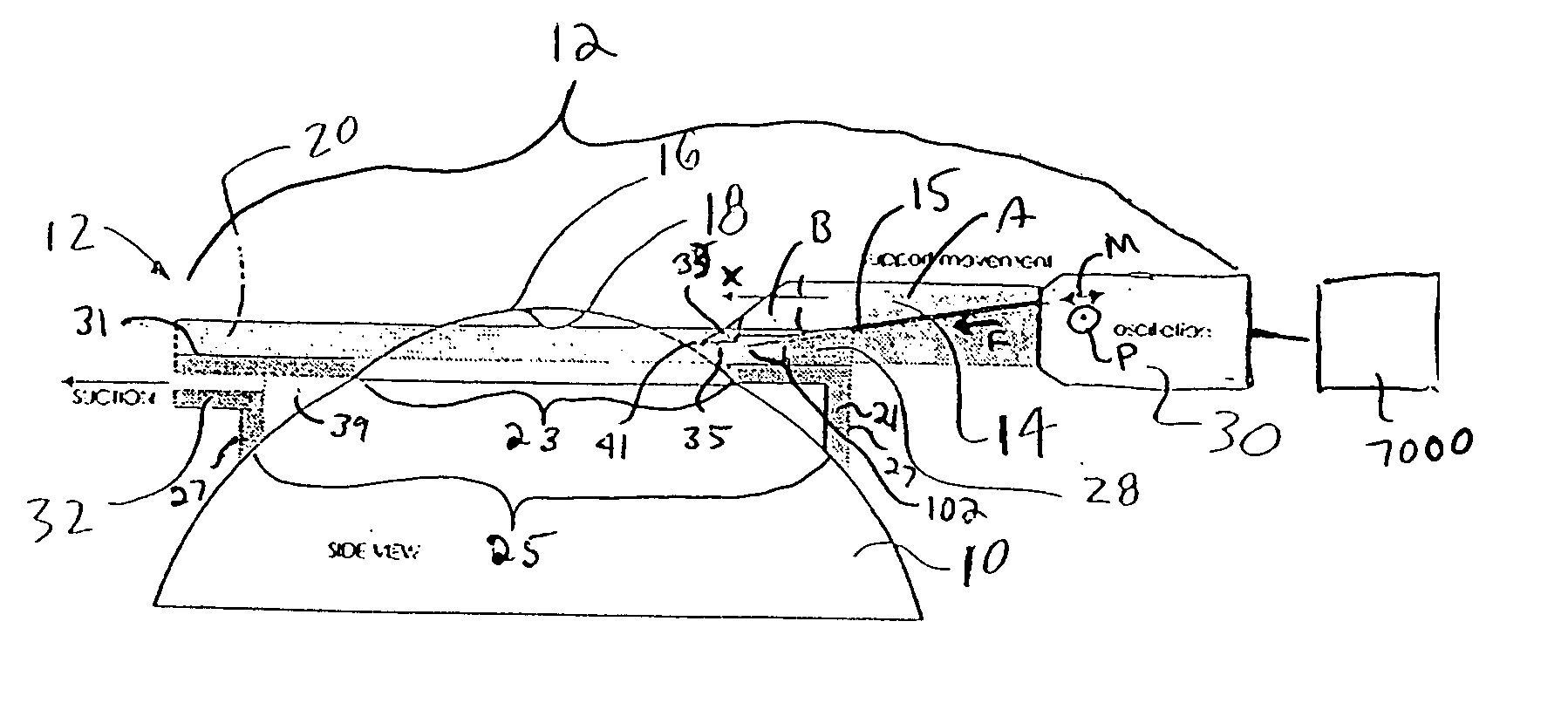 Device for separating the epithelial layer from the surface of the cornea of an eye