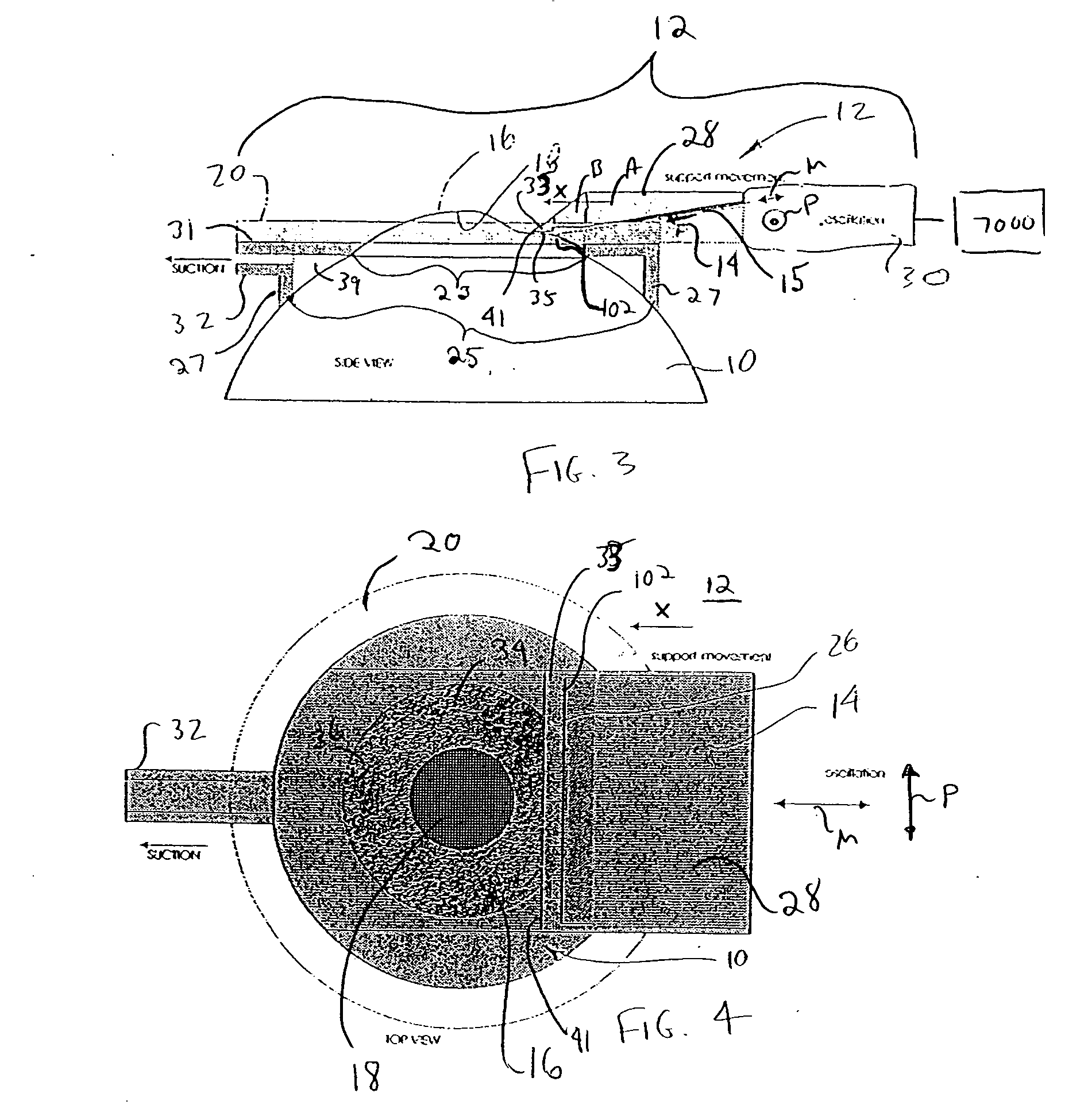 Device for separating the epithelial layer from the surface of the cornea of an eye