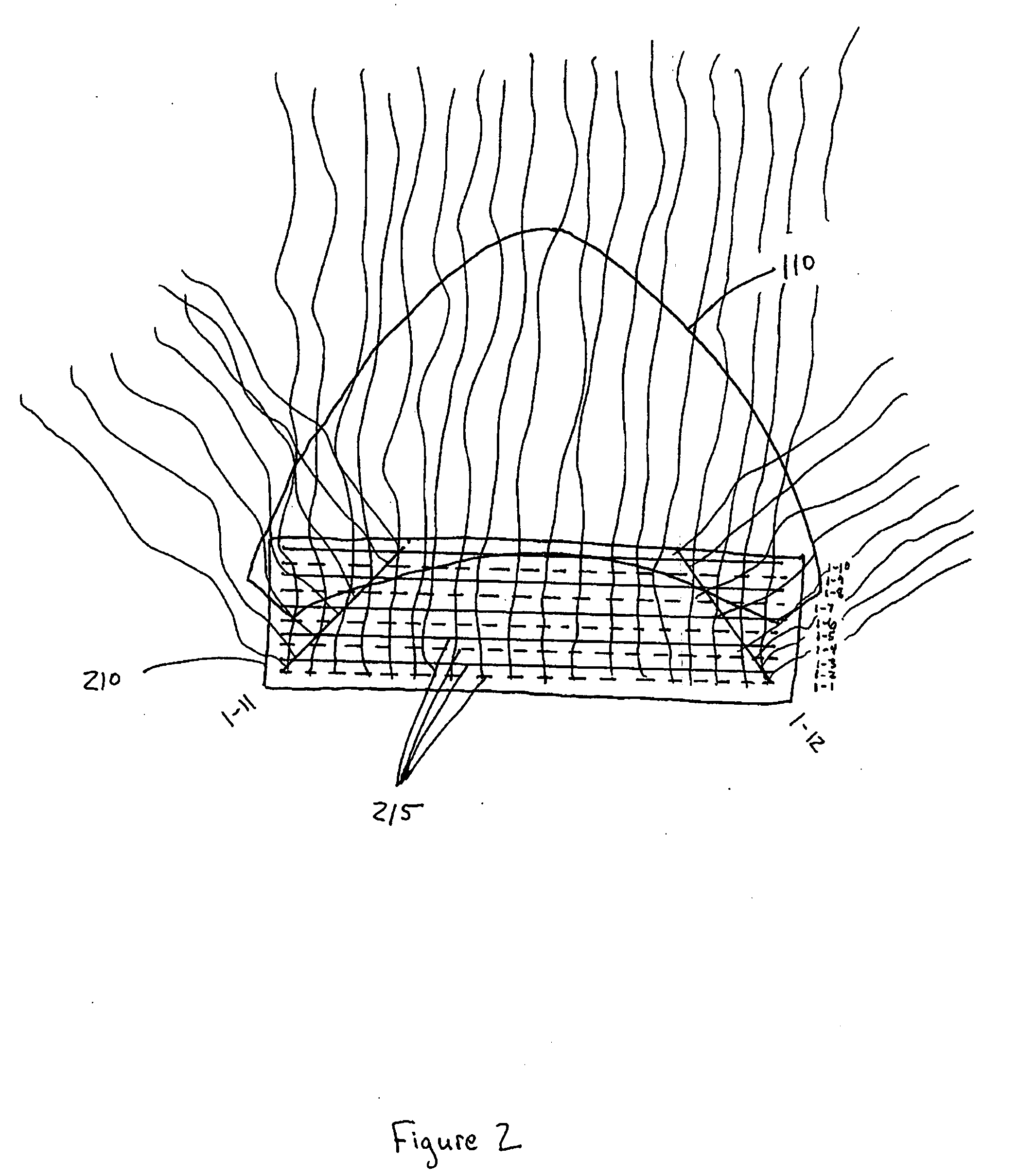 Detachable hairpiece and method for making the same