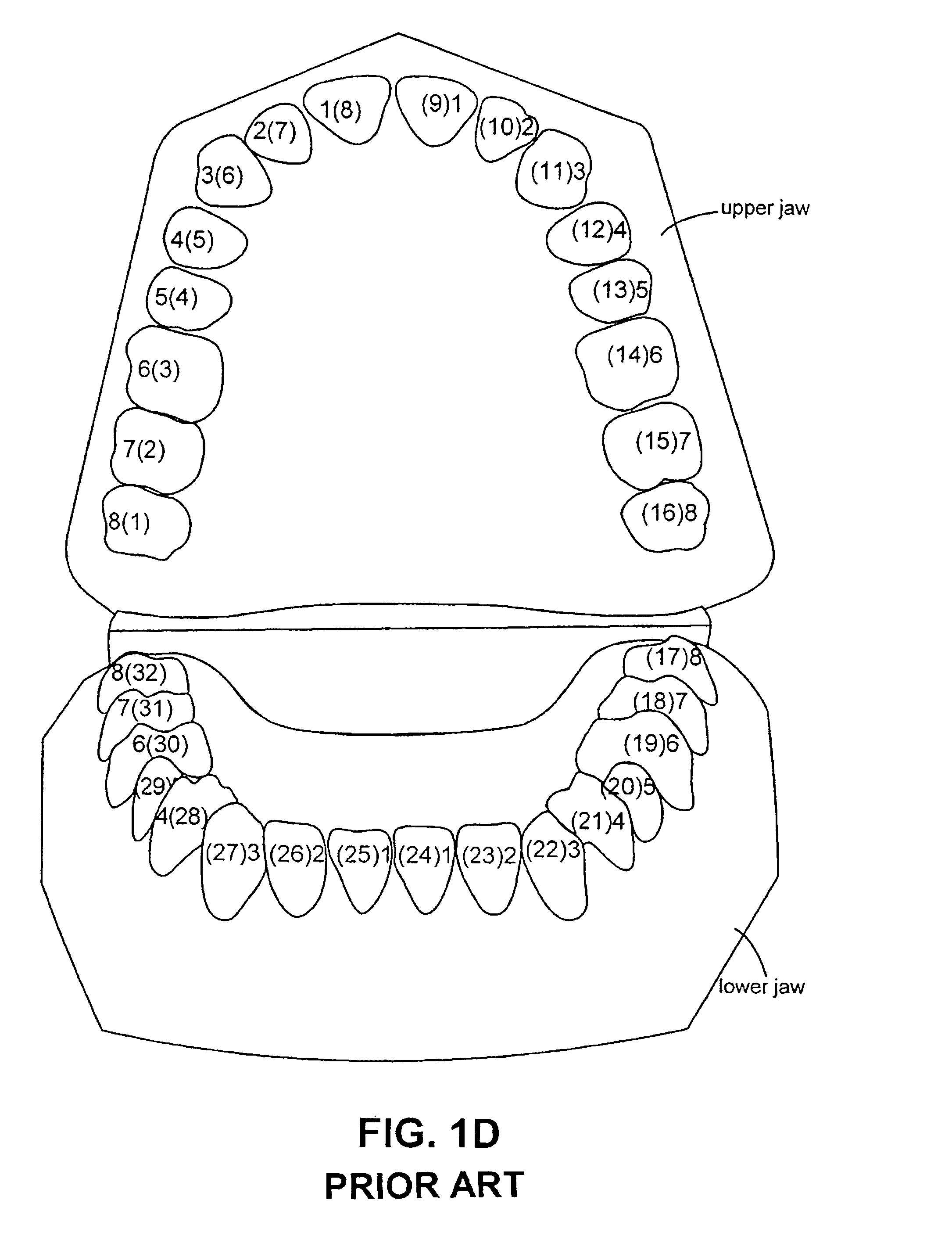 System and method for automatic detection of dental features