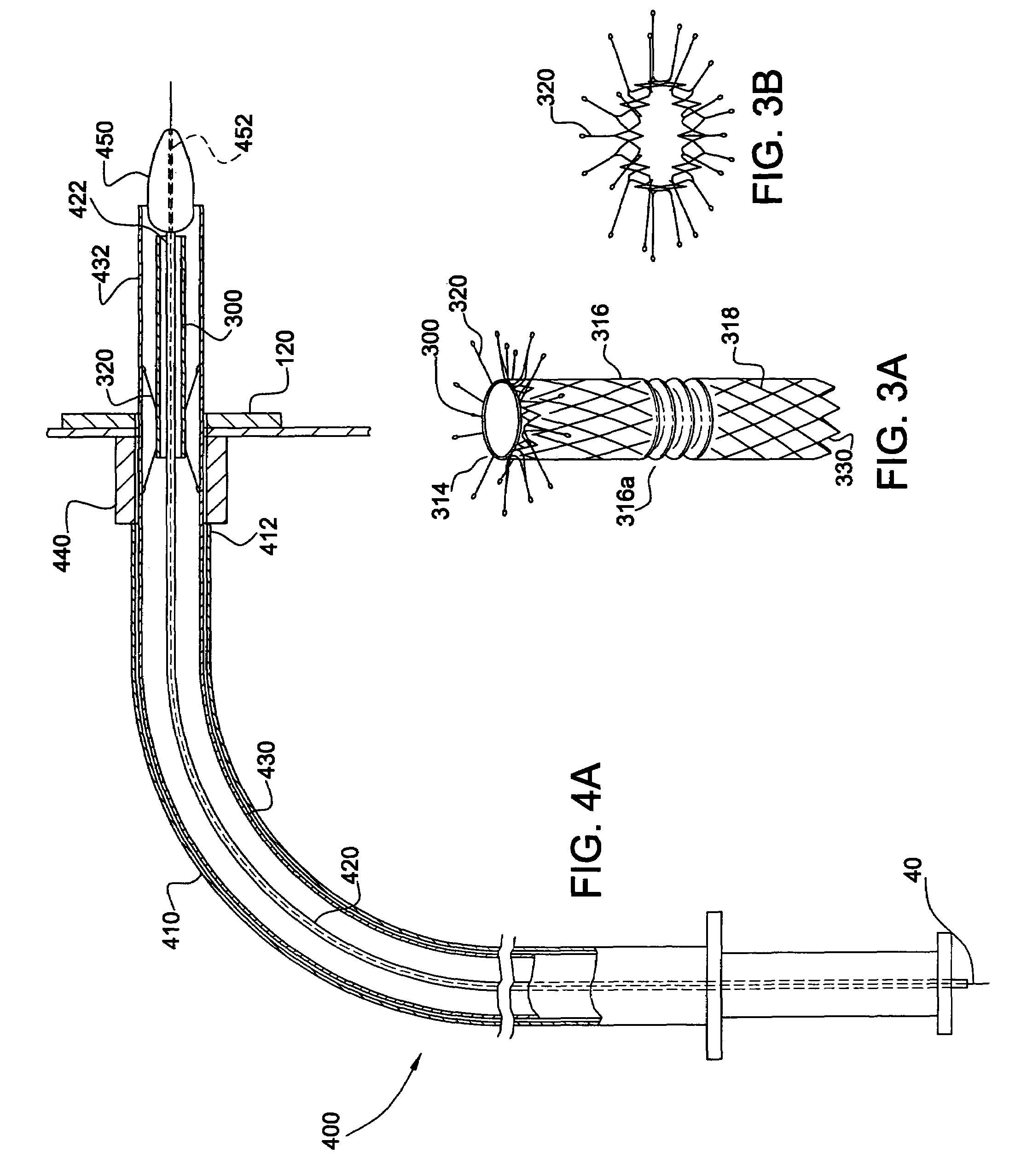 System and method for endoluminal grafting of bifurcated and branched vessels