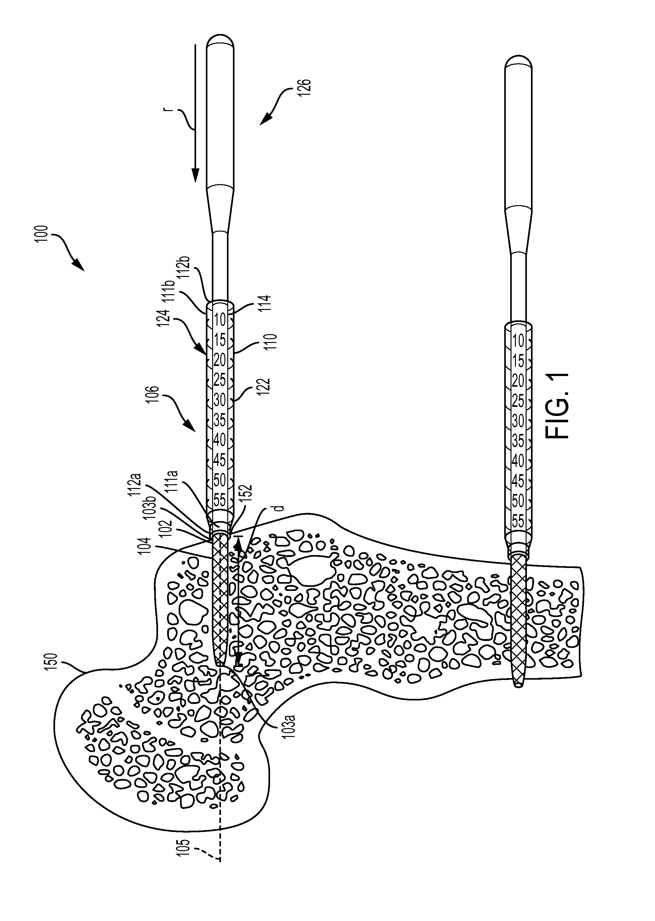 Woven retention devices, systems, packaging, and related methods