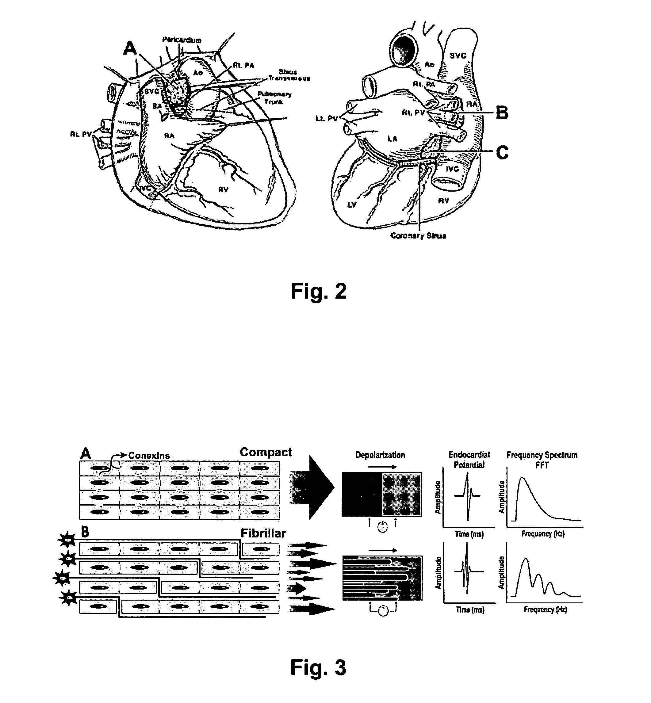 Method for arrhythmias treatment based on spectral mapping during sinus rhythm