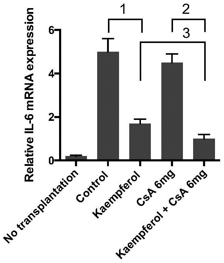 Application of kaempferol in drugs for inhibiting recipients' rejection of organ transplantation