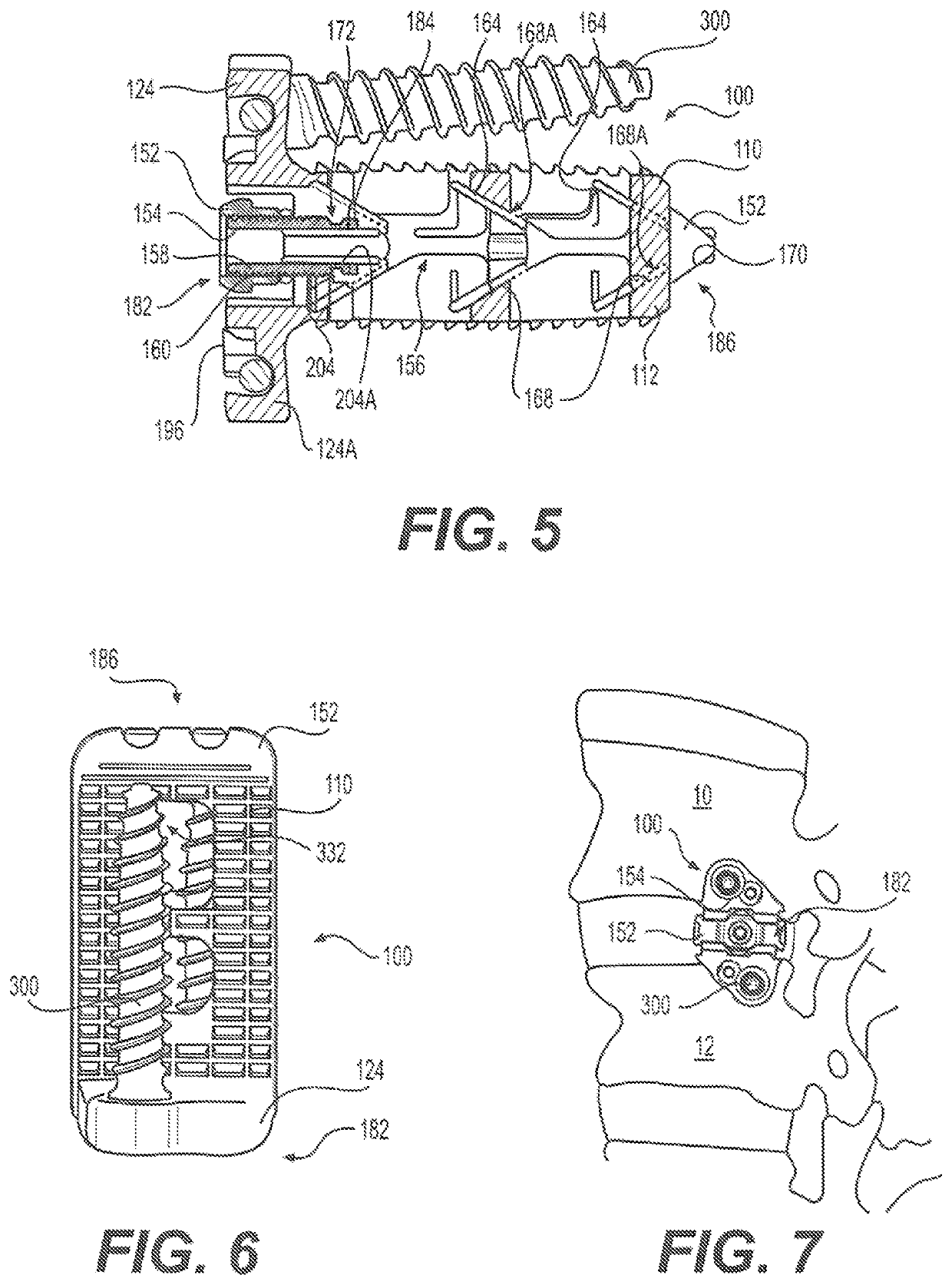 Expandable vertebral implant