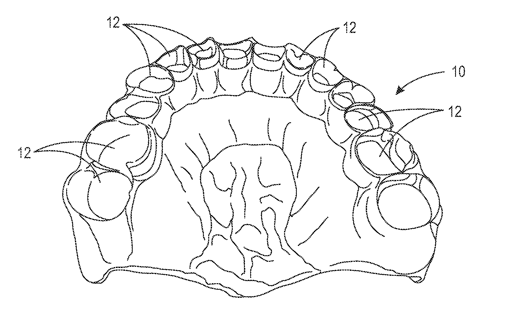 Molded denture and method and apparatus of making same