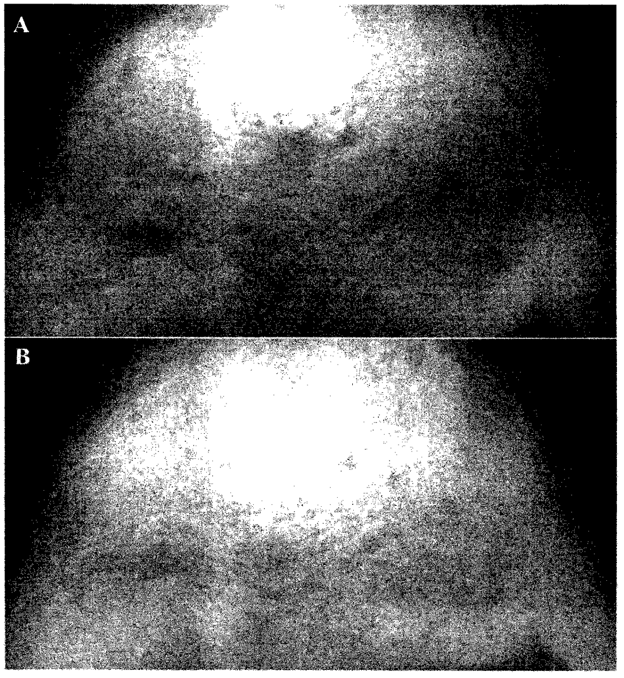 Preparation method and product of biological beauty raw material derived from immune cells