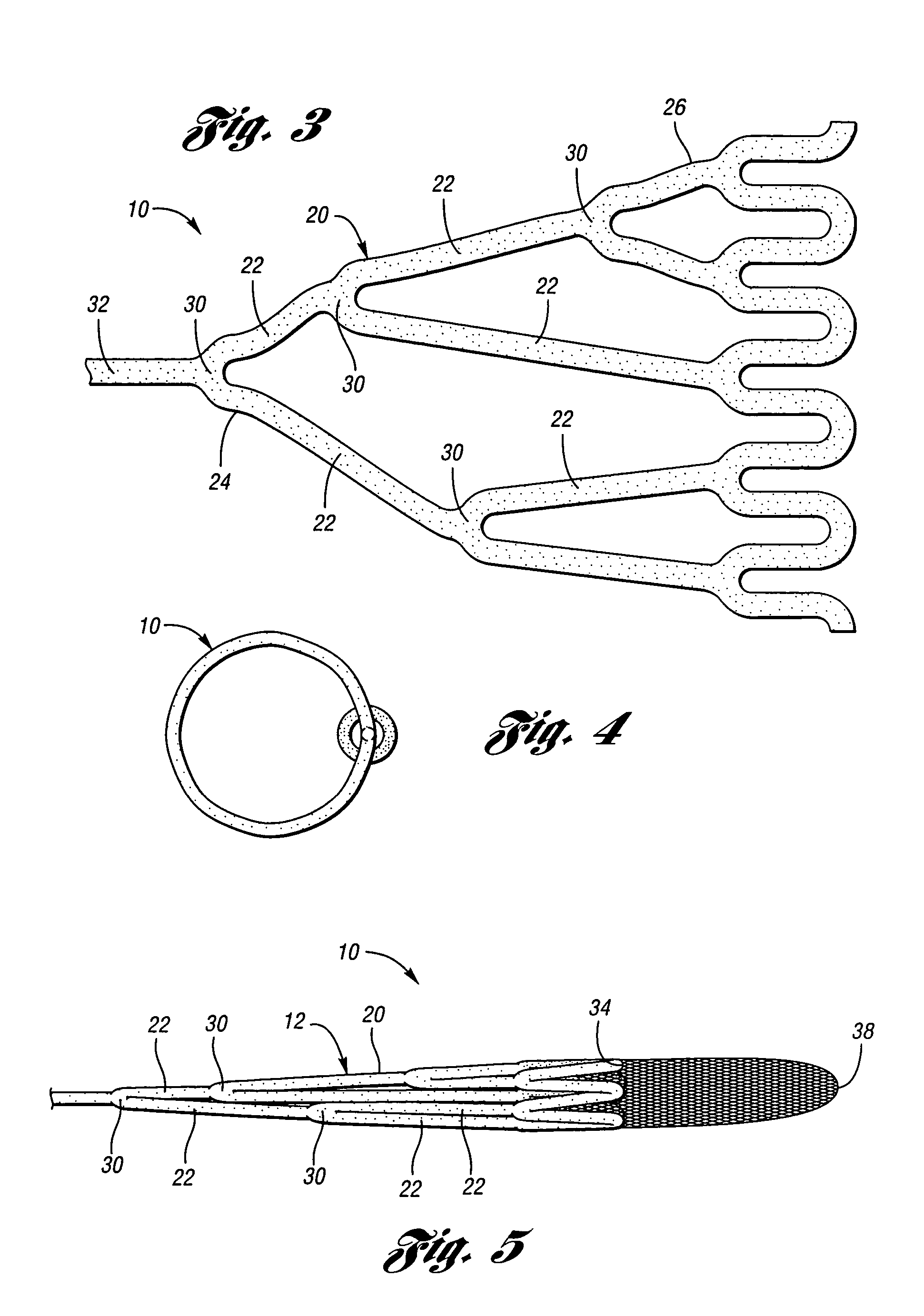 Embolic protection device having a reticulated body with staggered struts