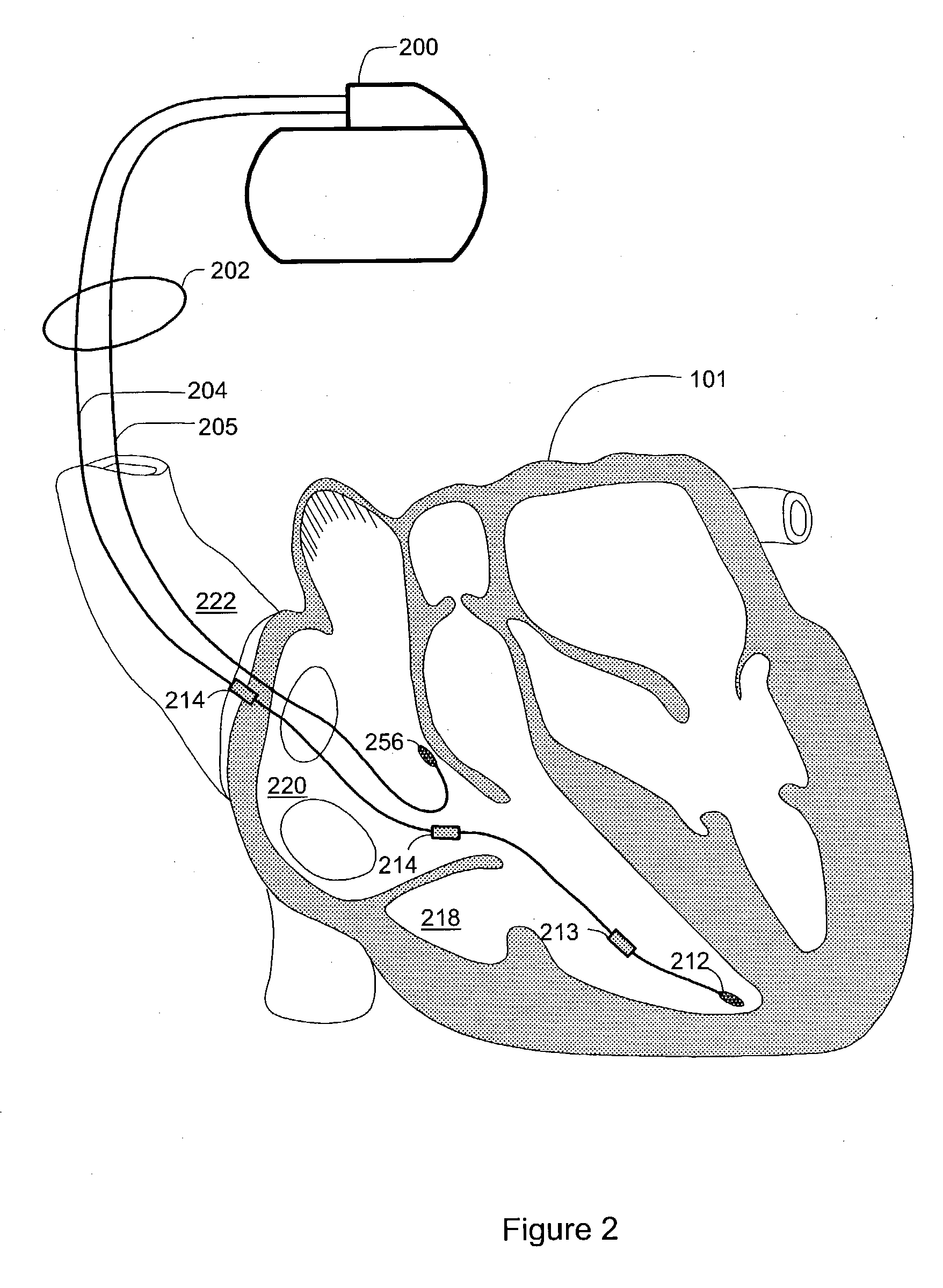 Sleep detection using an adjustable threshold