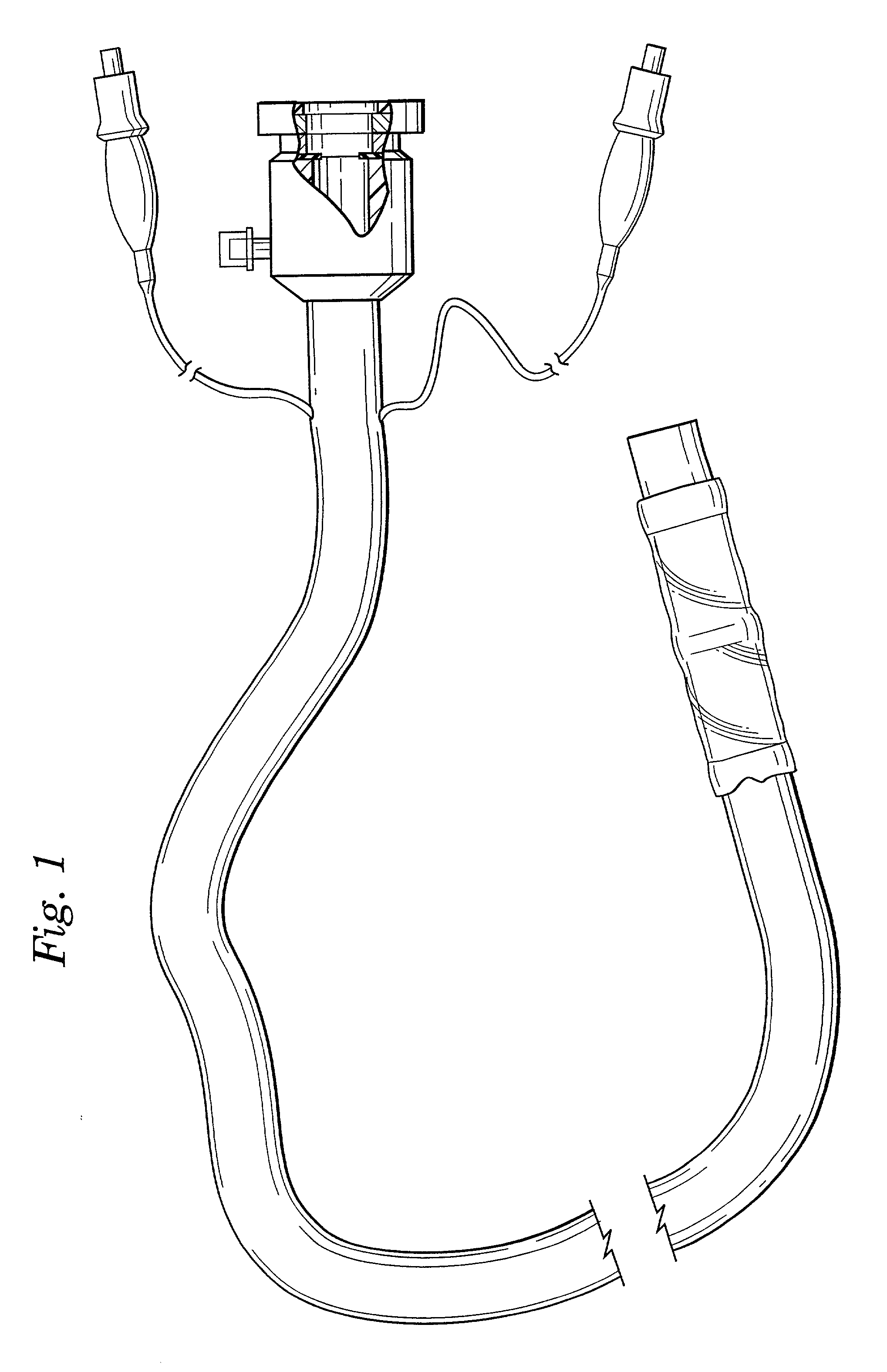 Methods and devices for diagnostic and therapeutic interventions in the peritoneal cavity