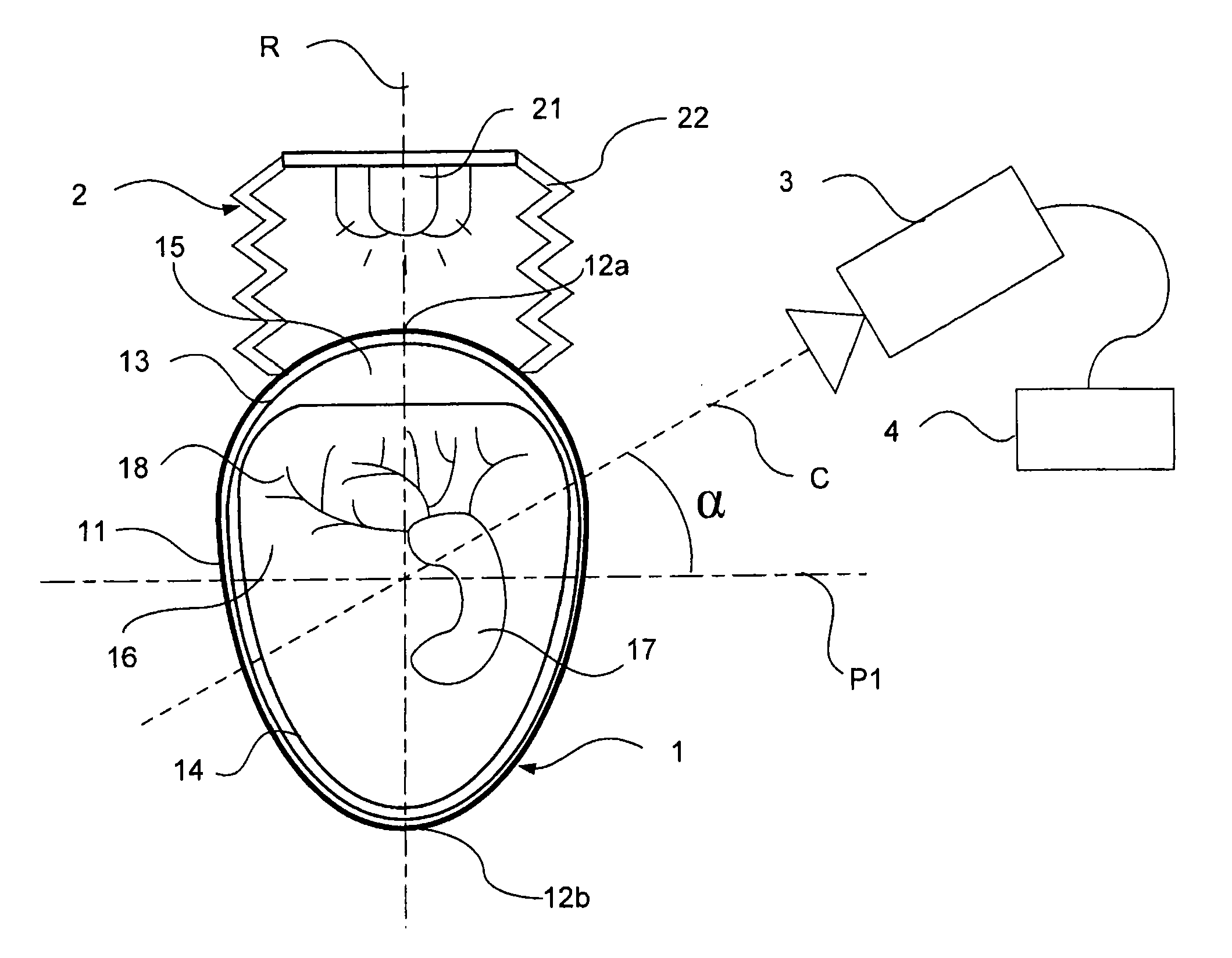 Egg candling method and corresponding device