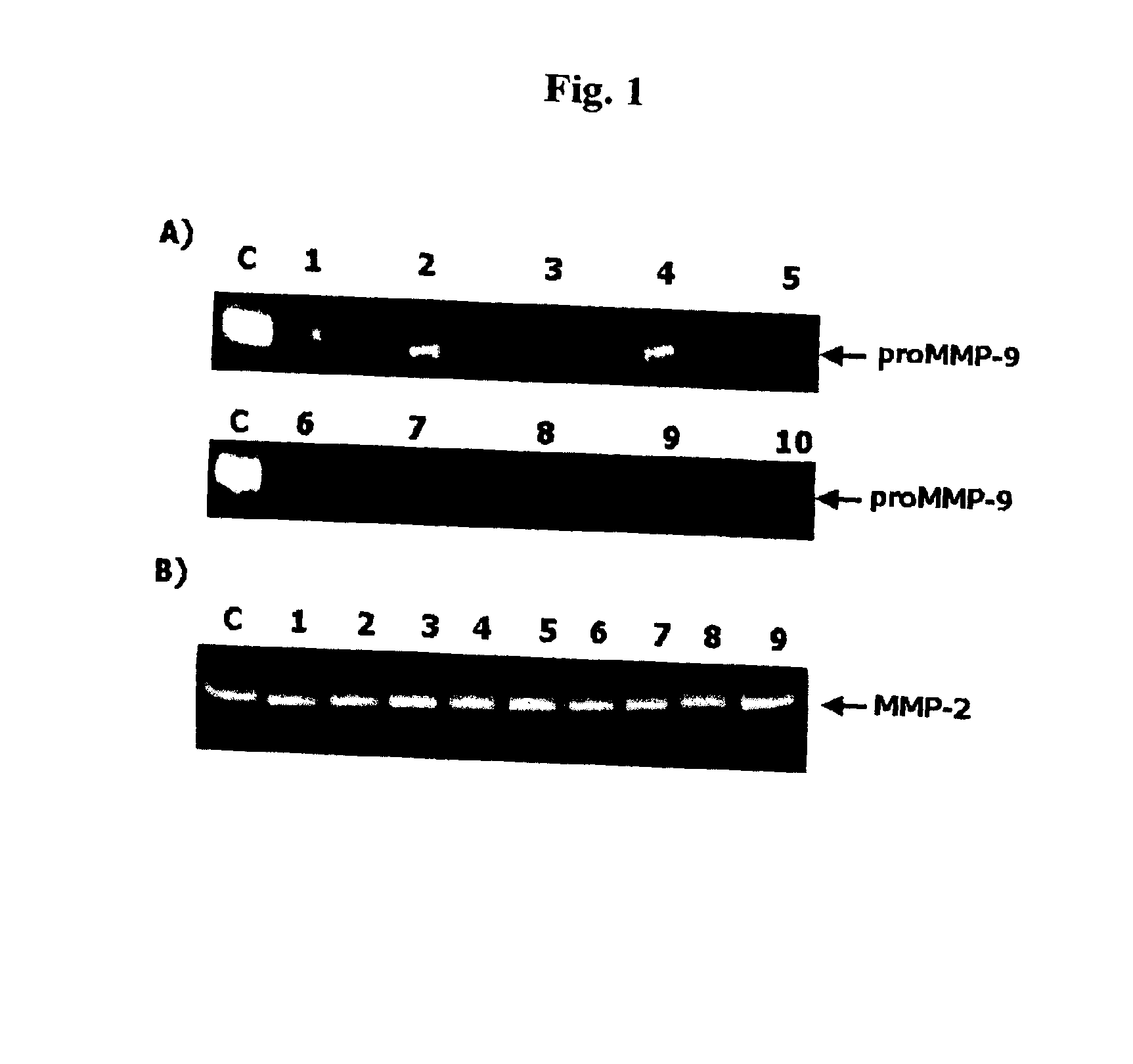 Method of diagnosing the chances of pregnancy and the diagnostic kit for the same