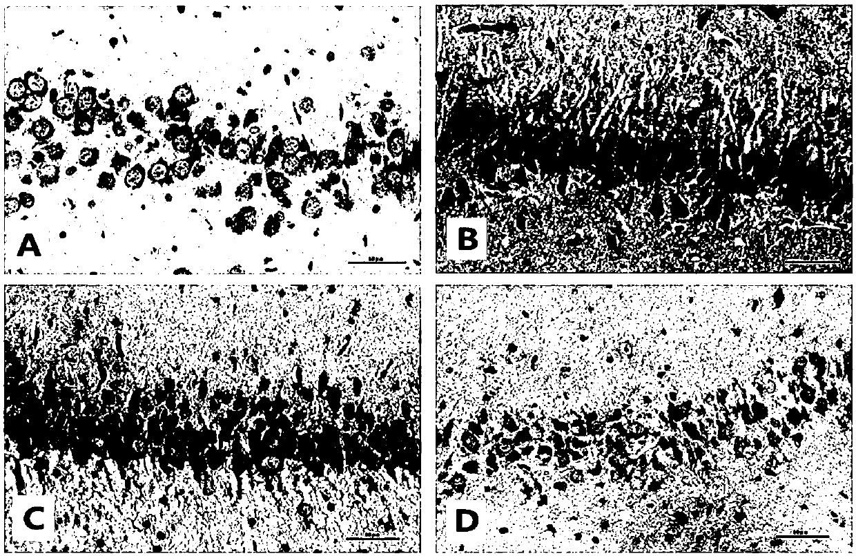Braf protein of biological marker for detecting brain damage induced by microwave radiation