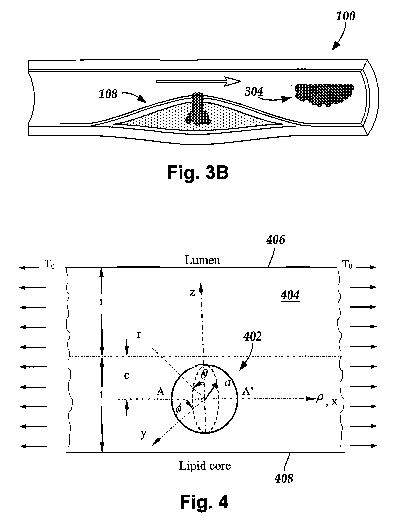 System and method for in vivo imaging of blood vessel walls to detect microcalcifications