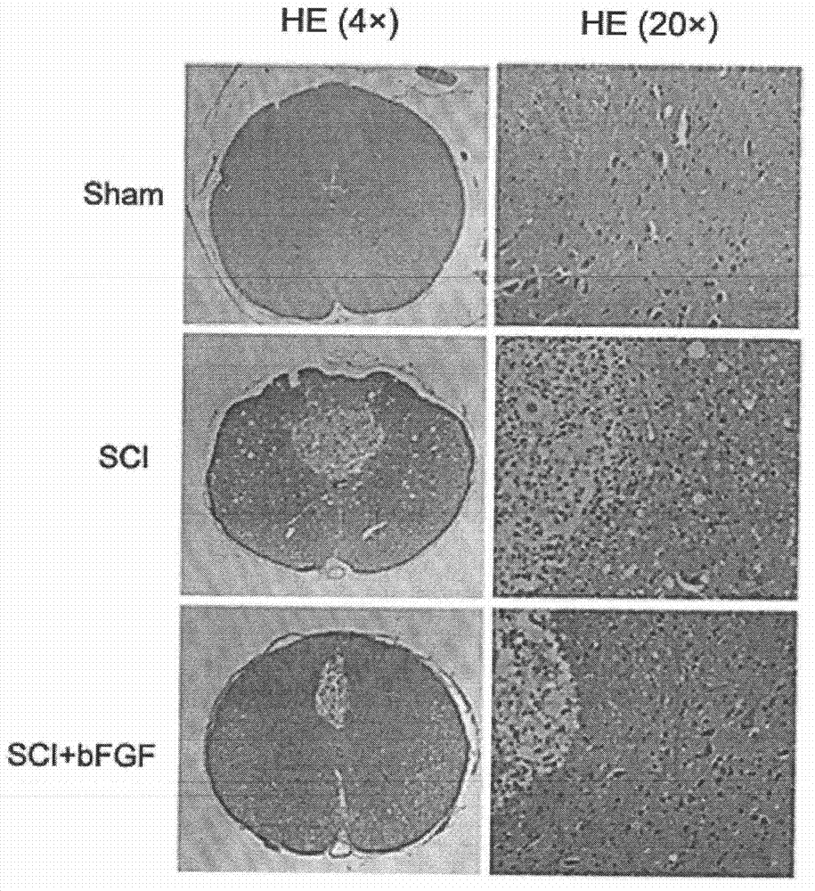 Applications of basic fibroblast growth factor in preparation of drugs for treatment of spinal cord injuries
