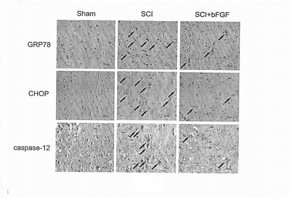 Applications of basic fibroblast growth factor in preparation of drugs for treatment of spinal cord injuries