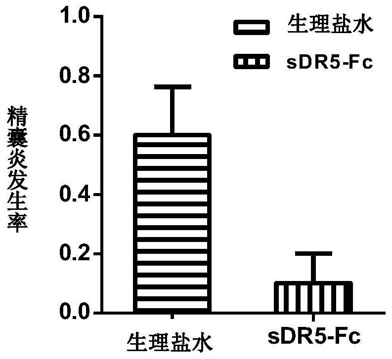 Human sdr5-fc recombinant fusion protein and its application as a medicine for treating reproductive system inflammation