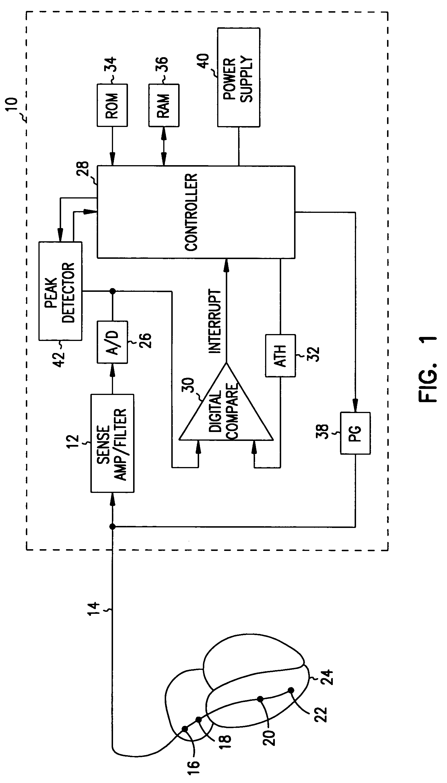 Method and apparatus for adjusting the sensing threshold of a cardiac rhythm management device