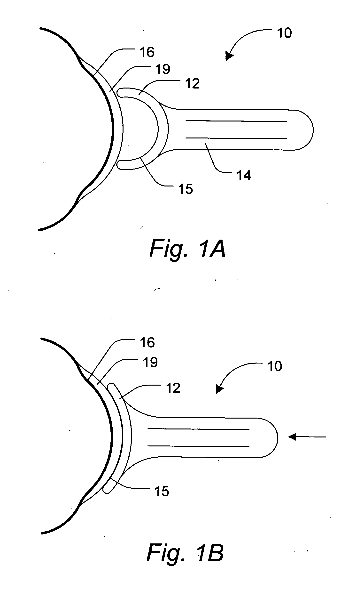 Contact lens device to remove or assist in the removal of a contact lens