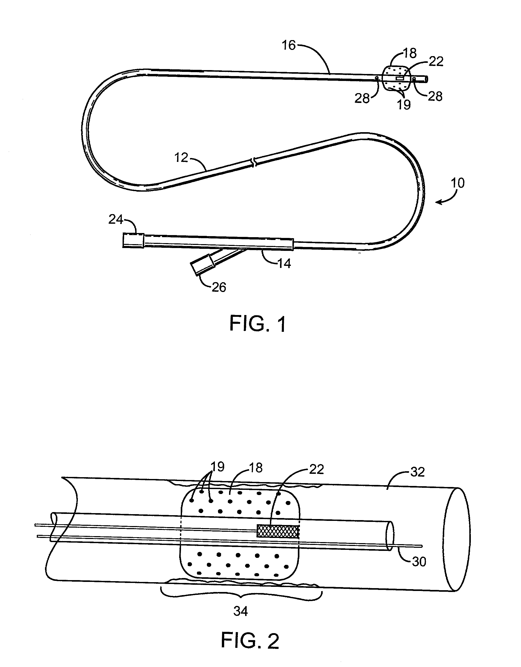 Combination ionizing radiation and immunomodulator delivery devices and methods for inhibiting hyperplasia