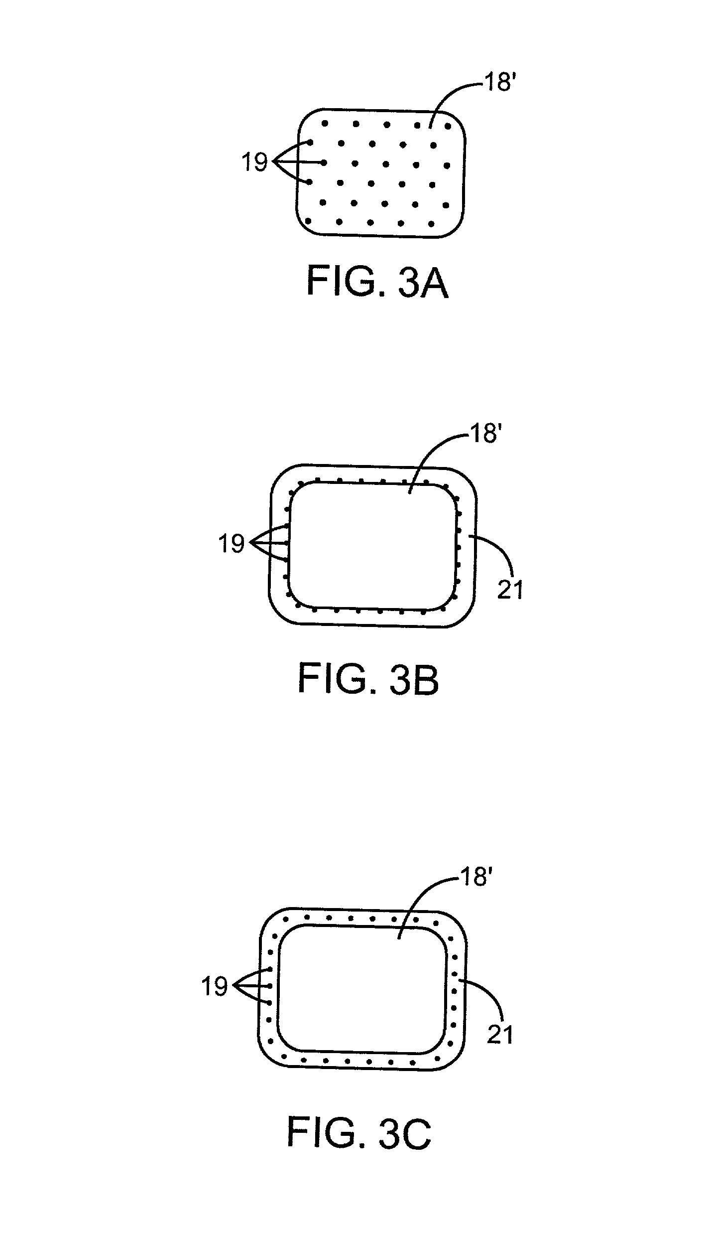 Combination ionizing radiation and immunomodulator delivery devices and methods for inhibiting hyperplasia