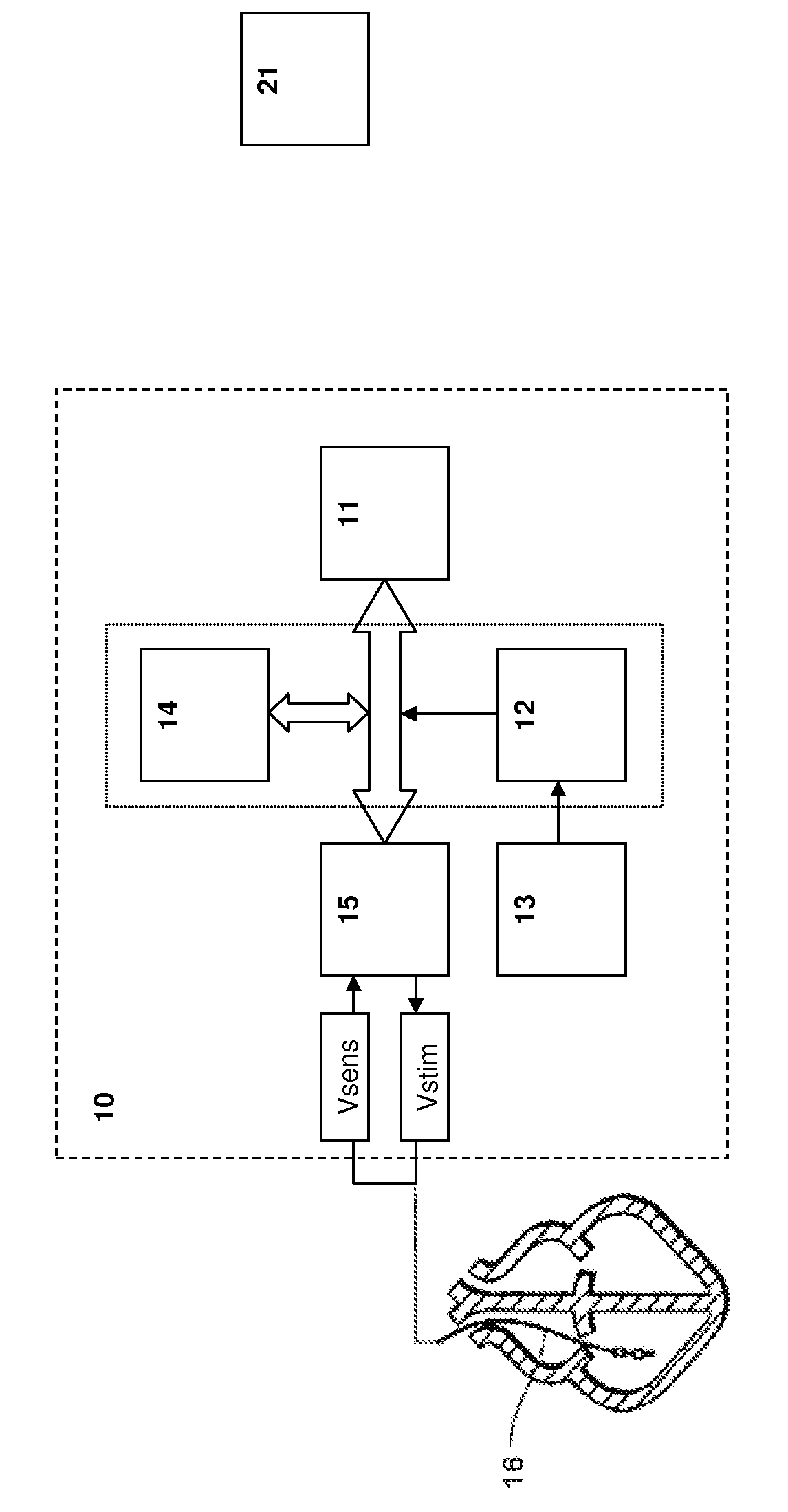 Implantable battery-operated electrostimulation device