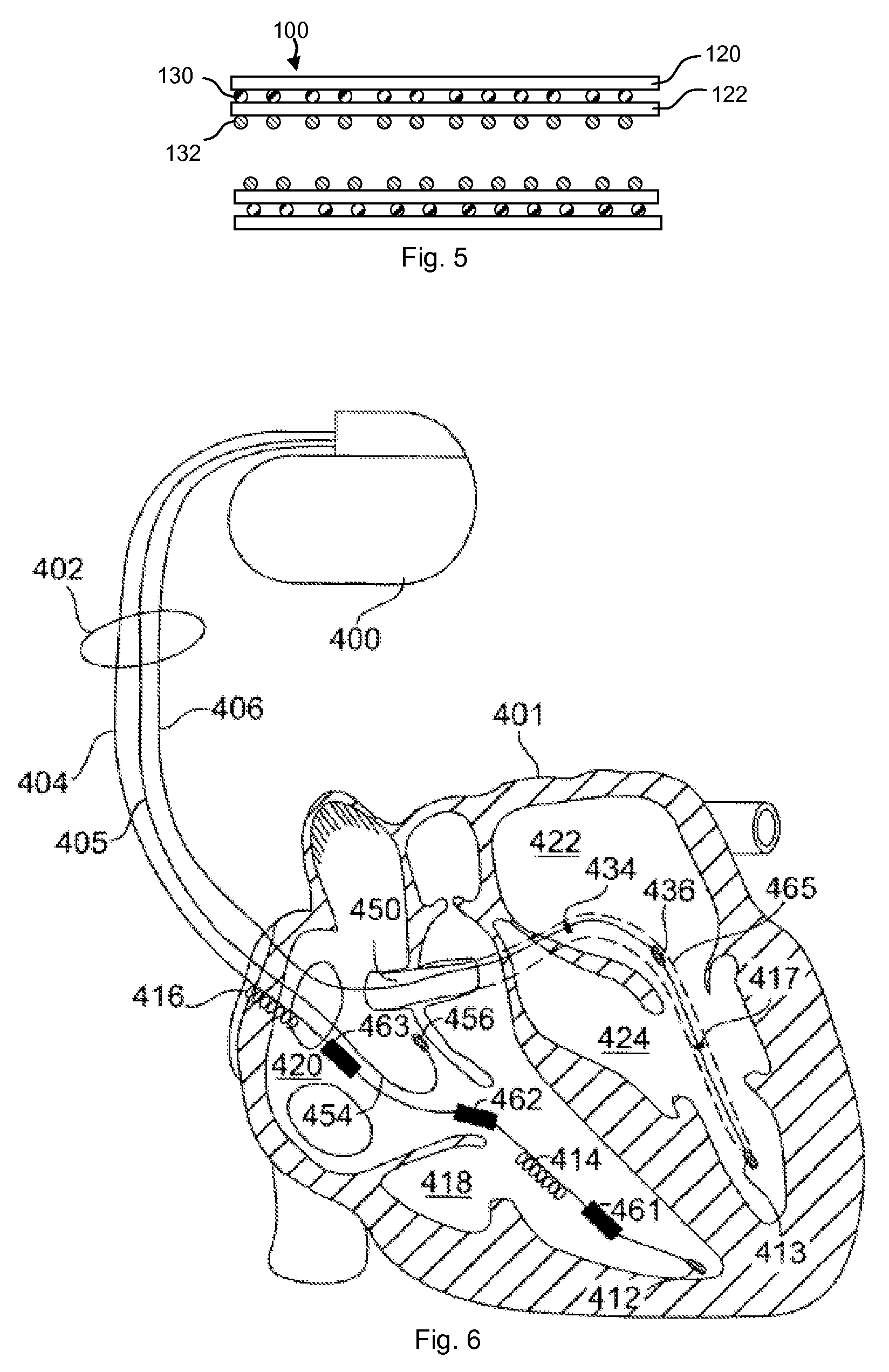 Styrene-isobutylene copolymers and medical devices containing the same