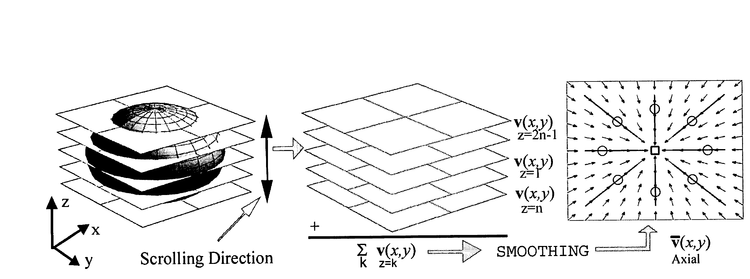 Method for detecting and classifying a structure of interest in medical images