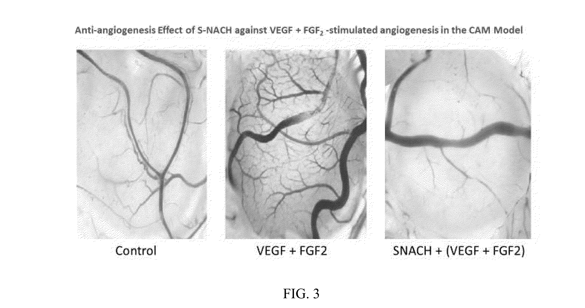 Ocular nanoformulation and method of use in angiogenesis-mediated disorders