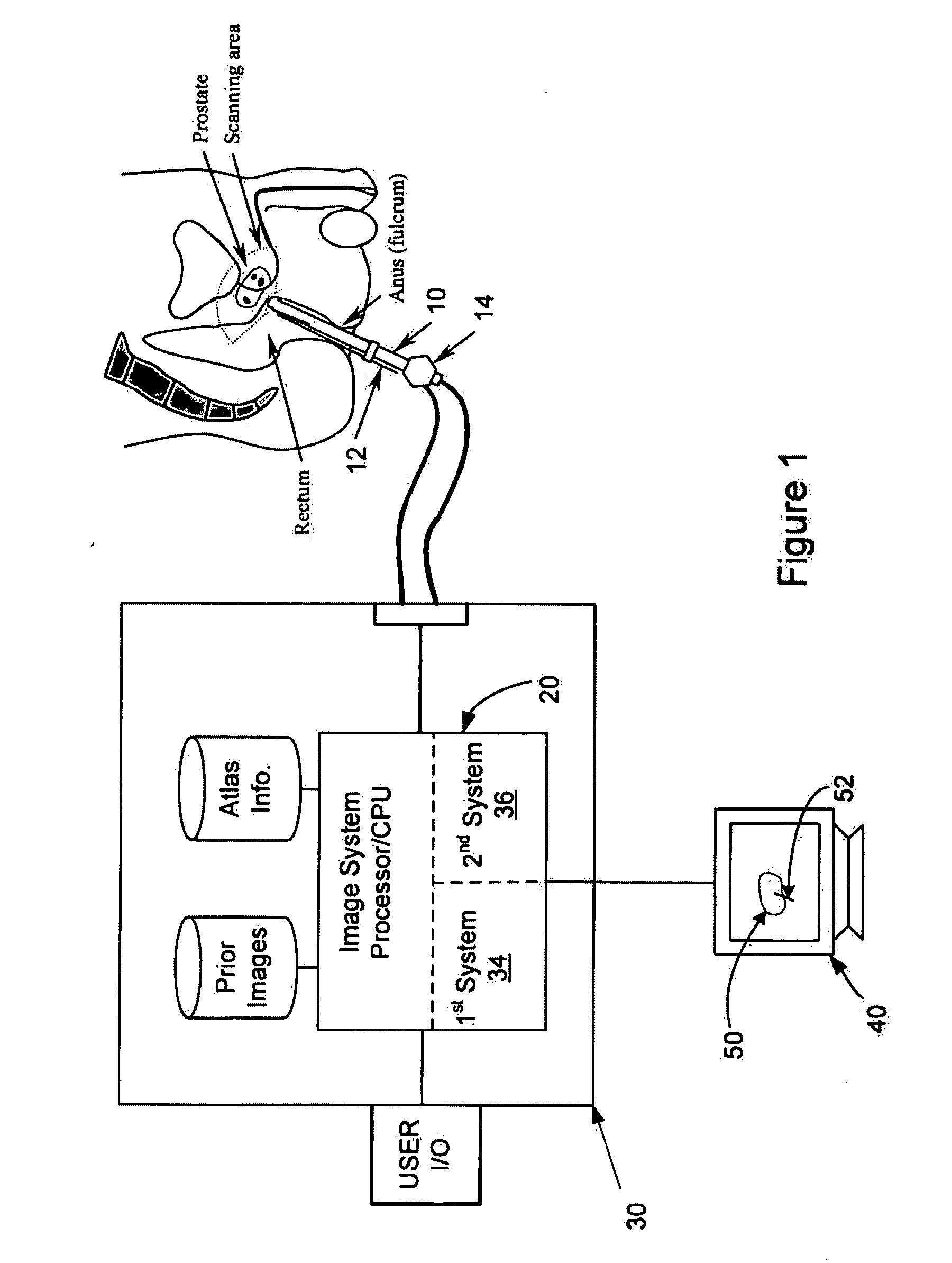 Method for tissue culture extraction