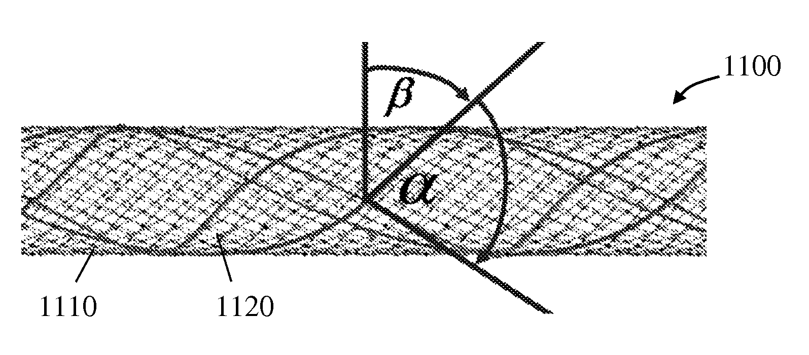 External support for elongated bodily vessels